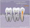 Jak znaleźć i leczyć kanały zębowe w Lumident