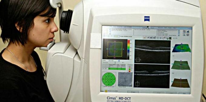 angiografia tomografii optycznej koherentnej
