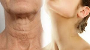 Jak pozbyć się zwiotczenie skóry na szyi
