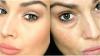 5 starych receptur, aby pomóc w podjęciu świeże spojrzenie i elastyczną skórę wokół oczu i młody