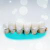 Najczęściej zęby szynowanie: ile skutecznie?