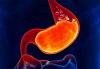 Ci żołądka: 6 nieoczywisty znaki