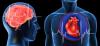 Atak serca i udar mózgu: 7 głównych błędów, które prowokują