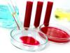 Poziom hemoglobiny we krwi: jak poprawić?
