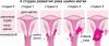 7 objawy raka szyjki macicy, które często ignorują kobiety