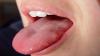 Tongue bolesność 7 głównych powodów